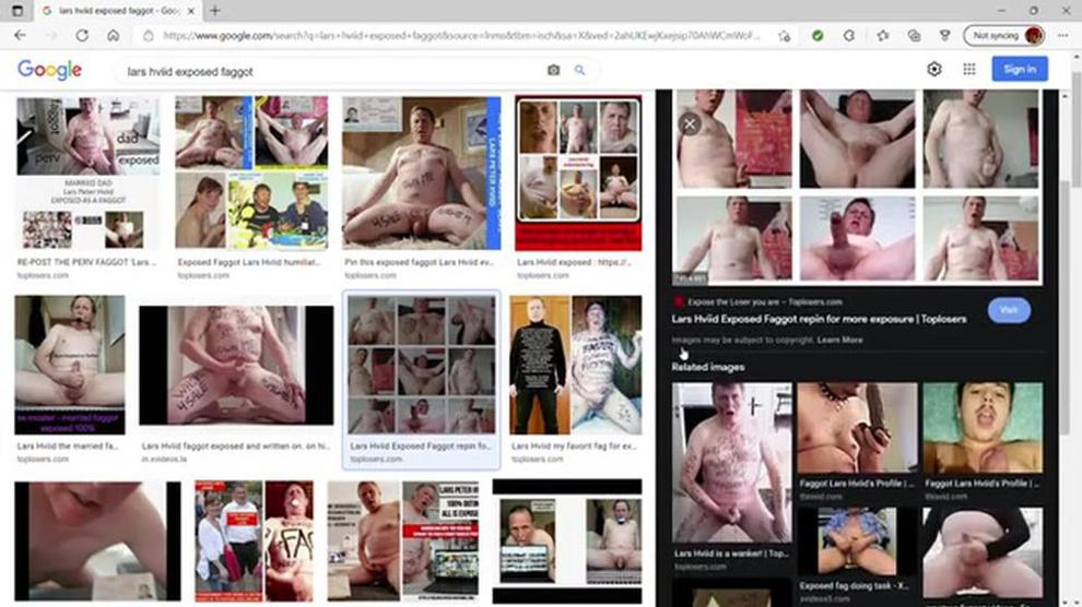 Lars Hviid Exposed Faggot as seen on Google MovieFap com 