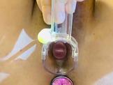 Speculum fun